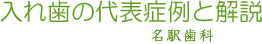 入れ歯の代表症例と解説